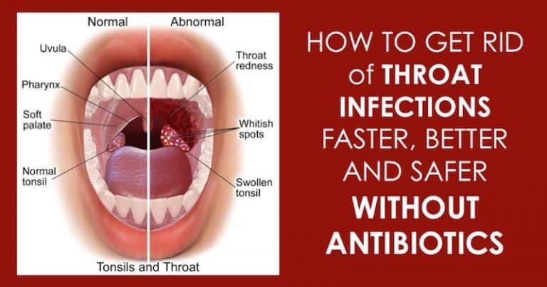 Home-Remedies-To-Cure-Strep-Throat