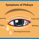 PINK-EYE-2