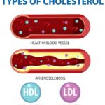 Lower-Cholesterol (1)