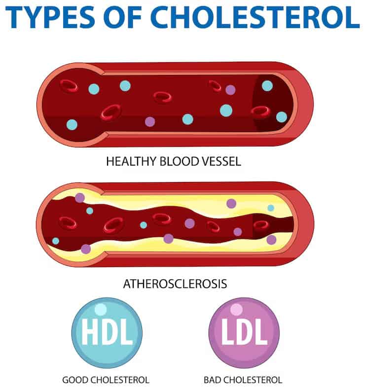 Lower-Cholesterol (1)